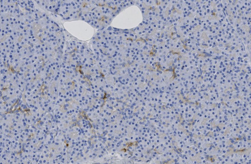 CK56_pancreas.jpg