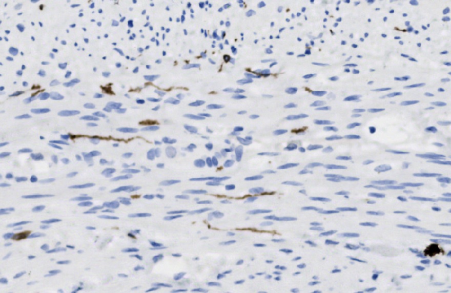 CD117b.jpg