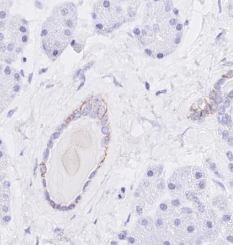CAD17 pancreas.png